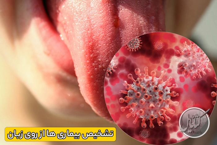 تشخیص بیماری ها از روی زبان