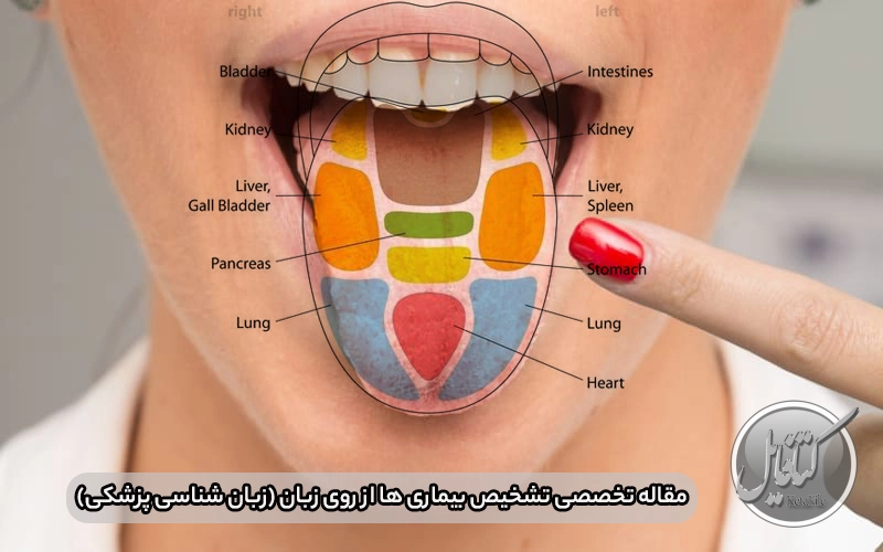 مقاله تخصصی تشخیص بیماری ها از روی زبان (زبان شناسی پزشکی)